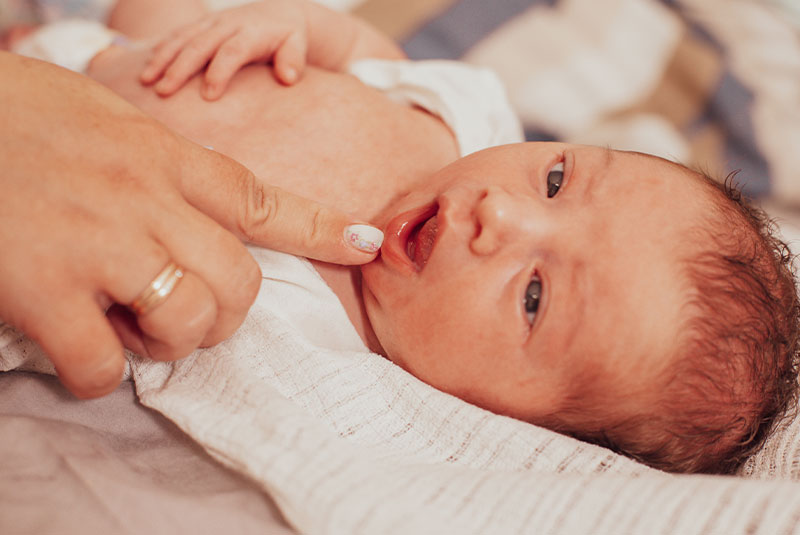 The examination of newborn baby mouth, frenulum of the tongue