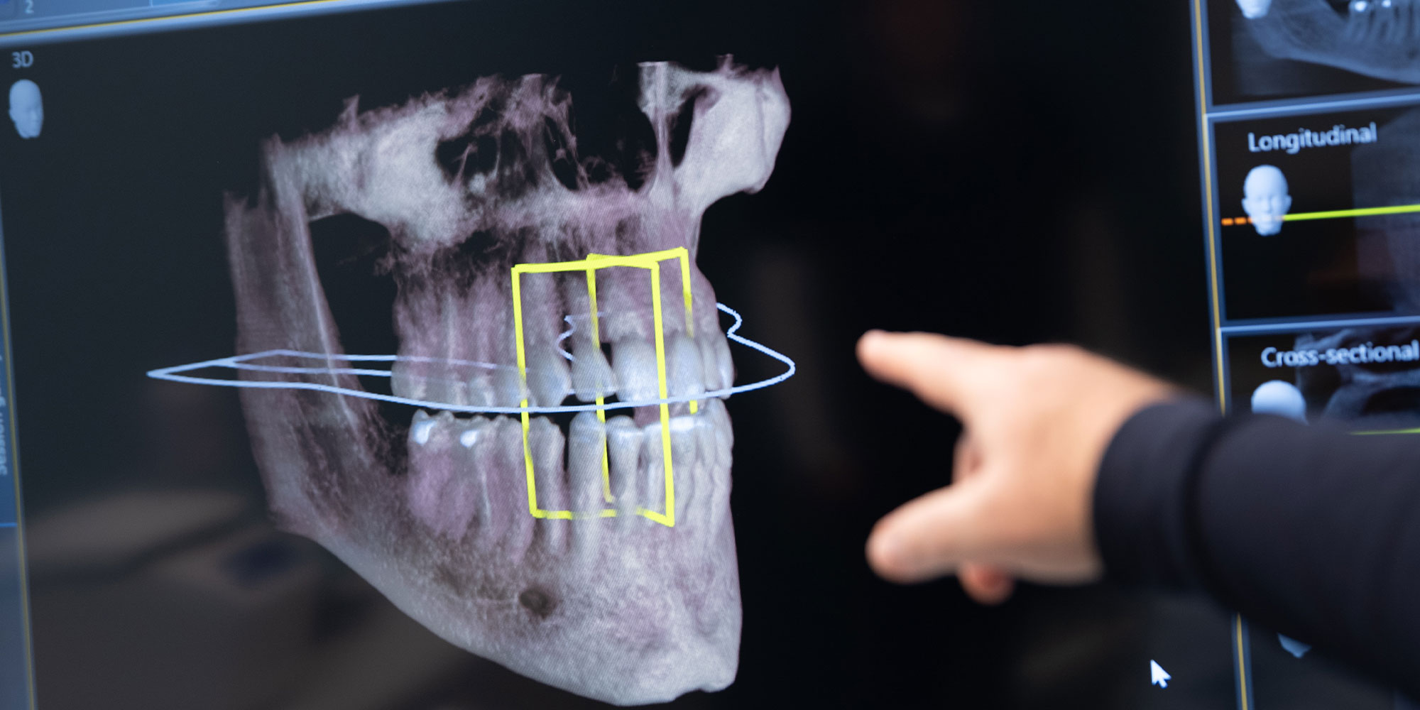 close up of dental x ray being shown on display